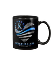 Hope for a cure Mug tile