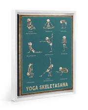 Yoga Skeletasana Yoga funny poster wall art Floating Framed Canvas Prints White tile