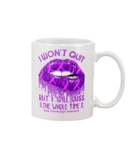 Fibromyalgia I Won't Quit Mug tile