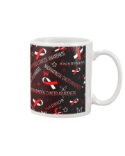 NASOPHARYNGEAL CANCER AWARENESS Mug thumbnail