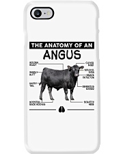 THE ANATOMY OF ANGUS Phone Case tile