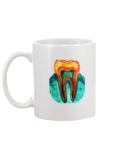 Molar Art Mug back