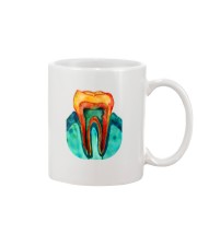 Molar Art Mug front