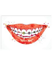 Teeth Brackets 17x11 Poster front