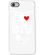 Halloween Costume TShirt Mom Candy Costume TSh Phone Case thumbnail