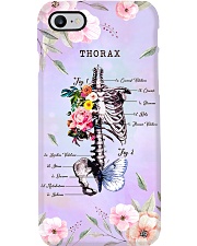 Radiologist Thorax Phone Case i-phone-7-case
