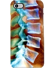 Chiropractor Spine Gift Phone Case i-phone-7-case