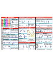 Paramedic EKG Interpretation 17x11 Poster front
