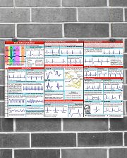 Paramedic EKG Interpretation 17x11 Poster poster-landscape-17x11-lifestyle-18