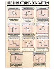 Life-Threatening ECG Pattern Cardiologist 11x17 Poster front