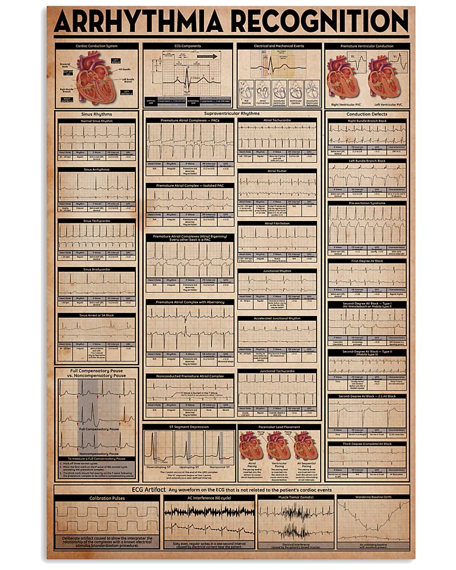 Paramedic Arrhythmia Recognition 24x36 Poster