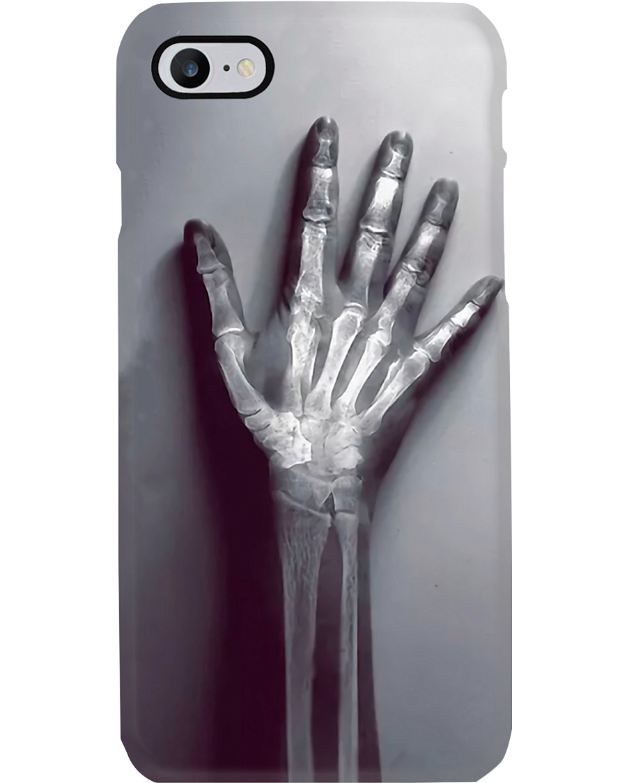 Radiologist Real X-ray Bone Phone Case