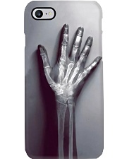 Radiologist Real X-ray Bone Phone Case i-phone-7-case