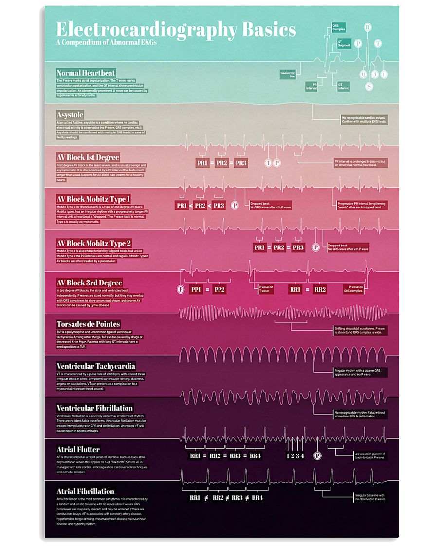 Cardiologist Electrocardiography Basics 11x17 Poster