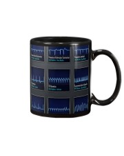 Paramedic ACLS Rythm Mug tile