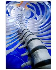 Chiropractor Spine 11x17 Poster front
