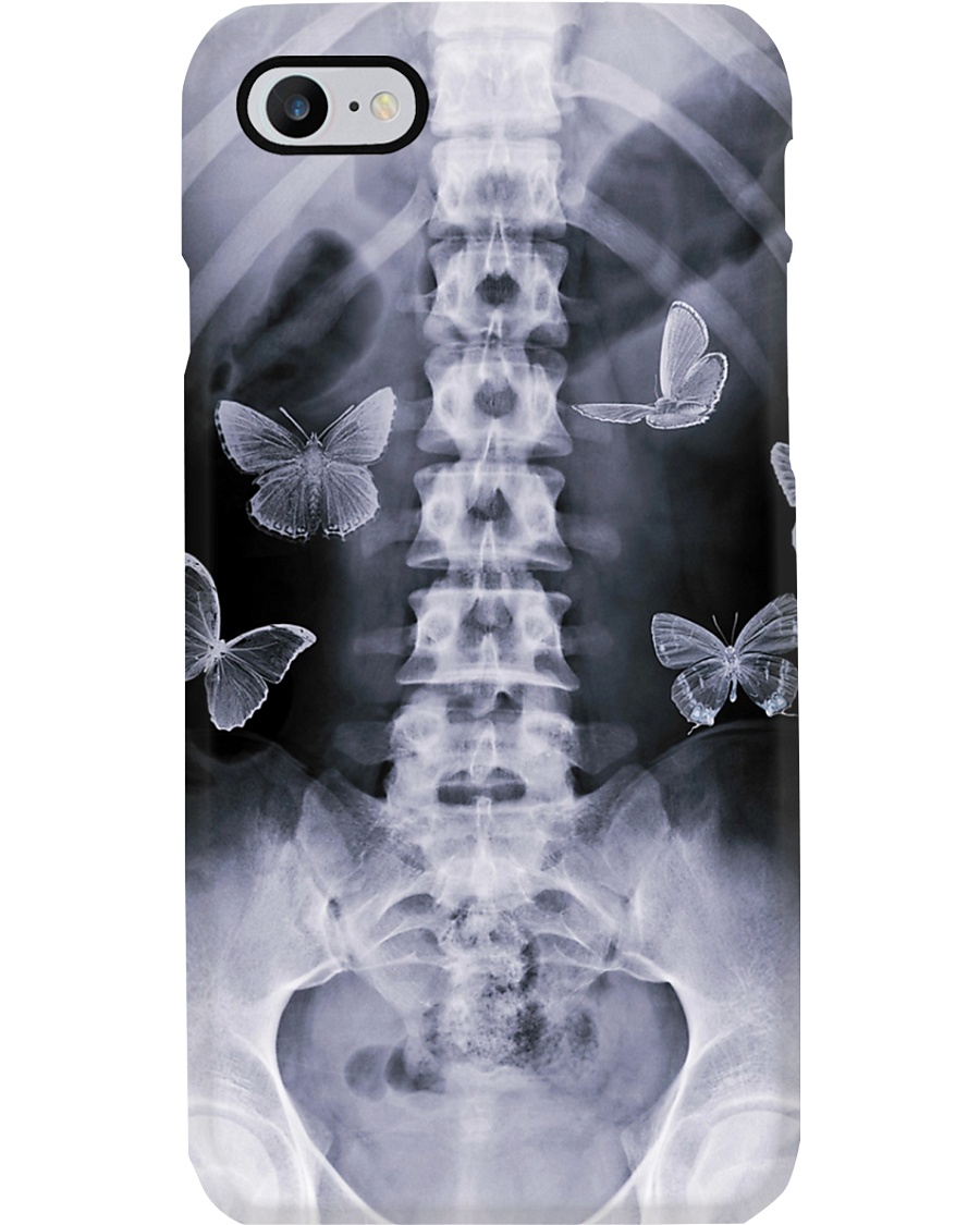 X-Ray Bone Image Radiologist Phone Case