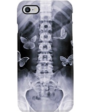 X-Ray Bone Image Radiologist Phone Case i-phone-7-case