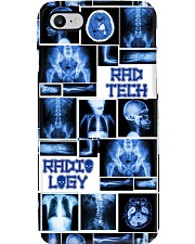 Rad Tech X-Ray Phone Case i-phone-7-case