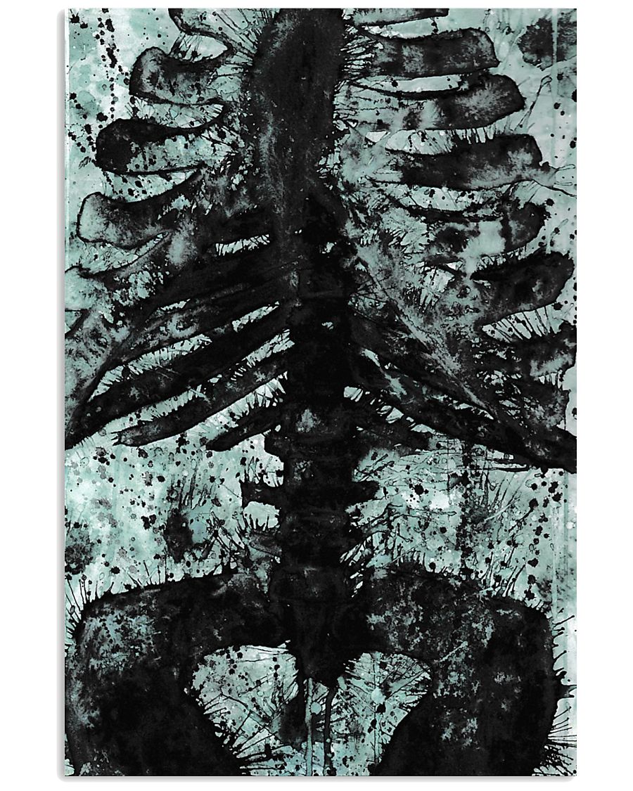 X-ray Print Radiology 11x17 Poster