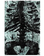 X-ray Print Radiology 11x17 Poster front