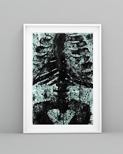 X-ray Print Radiology 11x17 Poster lifestyle-poster-5