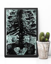 X-ray Print Radiology 11x17 Poster lifestyle-poster-8