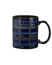 Cardiologist ACLS Rythm Mug tile