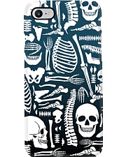 Skeleton Bone Radiology Phone Case i-phone-7-case