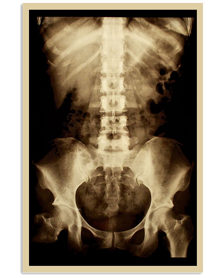 X-ray Film Radiology 11x17 Poster