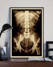 X-ray Film Radiology 11x17 Poster lifestyle-poster-2