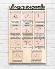Paramedic Life -Threatening ECG Pattern 11x17 Poster aos-poster-portrait-11x17-lifestyle-17