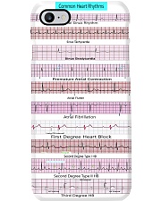 Normal ECG Cardiologist Phone Case i-phone-7-case