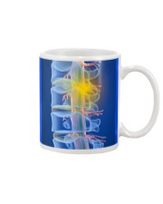 Chiropractor - Spine Art Mug thumbnail