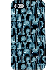 Many X-ray Images Radiologist Phone Case i-phone-7-case