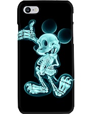 X-ray Micky Radiologist Phone Case i-phone-7-case
