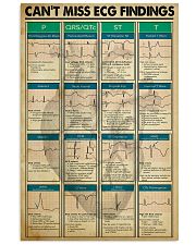 Paramedic Can't Miss ECG Findings 11x17 Poster front