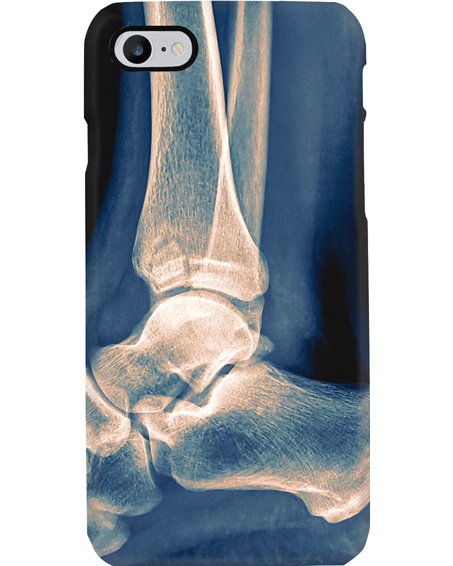 Radiologist X-ray Ankle Phone Case