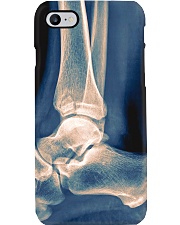 Radiologist X-ray Ankle Phone Case i-phone-7-case