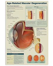 Optometrist Age-Related Macular Degeneration 11x17 Poster front