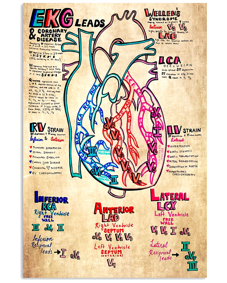 Paramedic EKG Leads 11x17 Poster