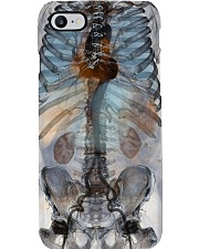 Body X-ray Radiology Phone Case i-phone-7-case