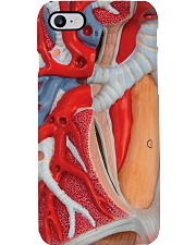 Respiratory Therapist Lung Phone Case i-phone-7-case