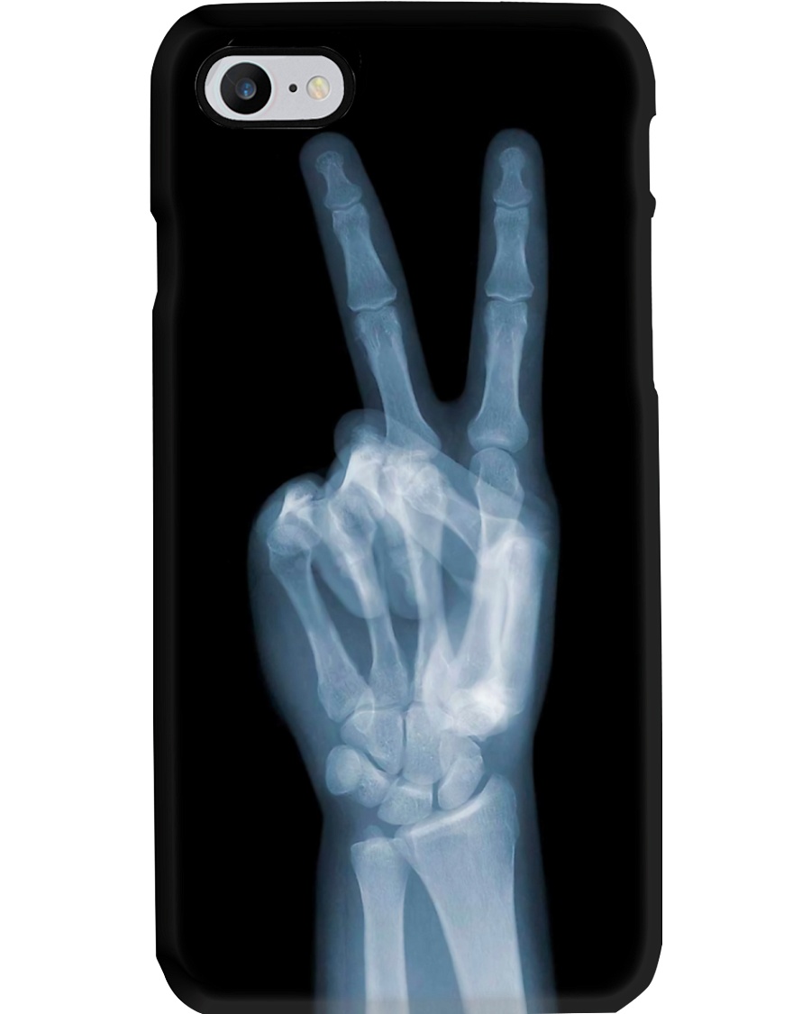 X-ray Peace Sign Radiologist Phone Case