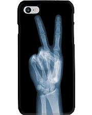 X-ray Peace Sign Radiologist Phone Case i-phone-7-case