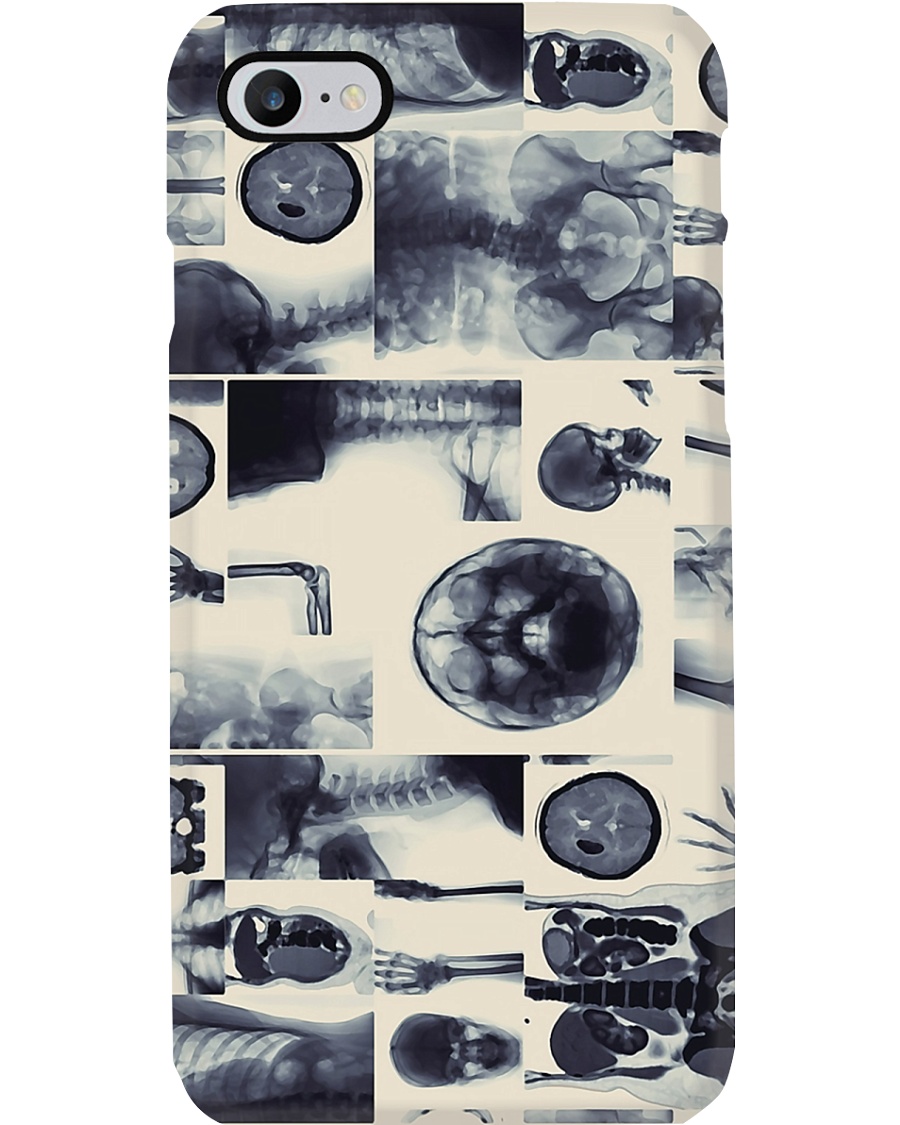 X-ray Image Radiology Phone Case