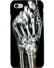 Hand X-ray Radiology Phone Case i-phone-7-case