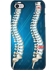 Chiropractor Gift Phone Case i-phone-7-case
