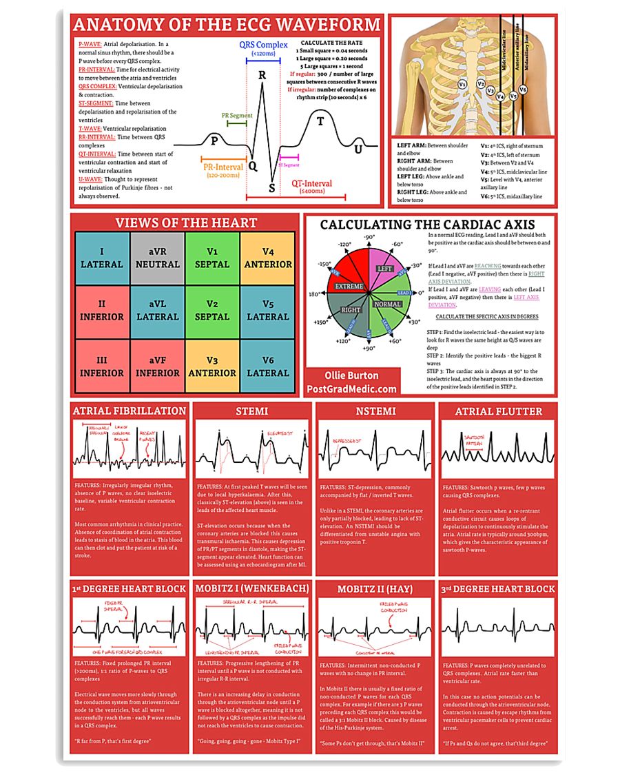 Paramedic Anatomy Of The EGC Waveform 11x17 Poster