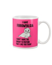 i have FIBROMYALGYA Mug thumbnail